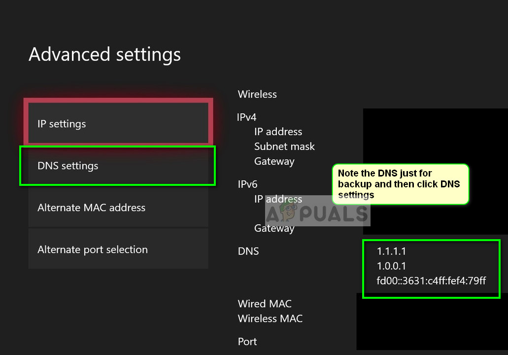 DNS Settings in Xbox console