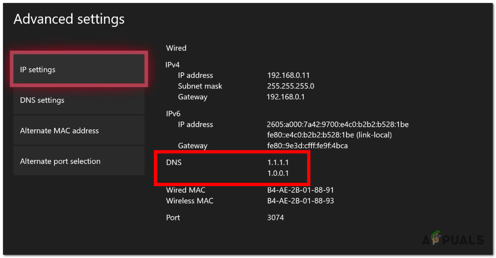Setting the Cloudflare DNS on Xbox