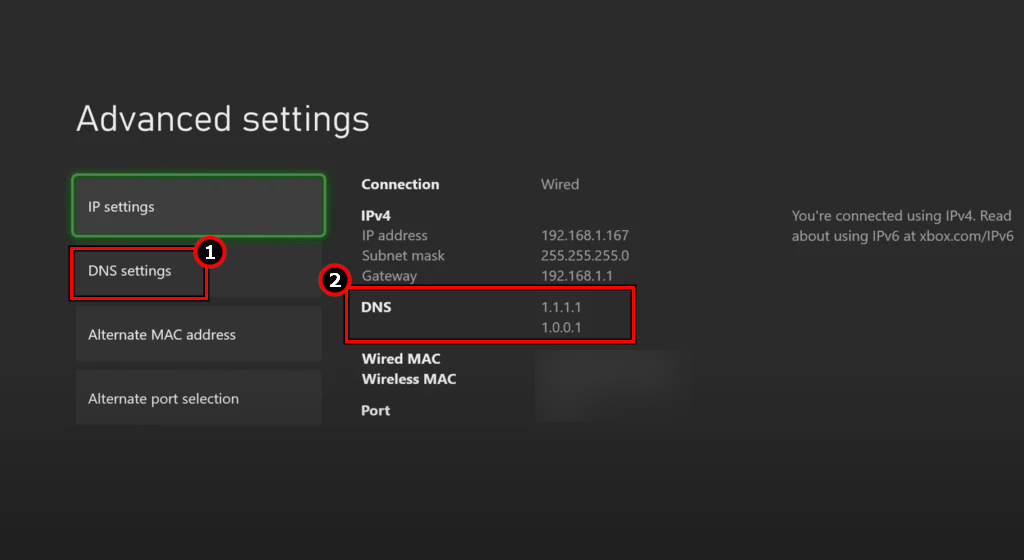 Change the DNS Settings of the Xbox